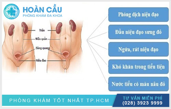 Viêm niệu đạo căn bệnh phổ biến ở cơ quan sinh dục Nguyen-nhan-cach-dieu-tri-viem-nieu-dao-1