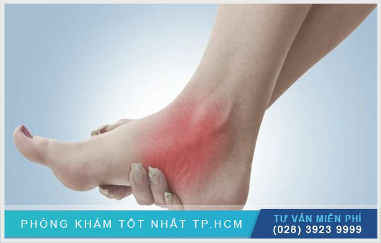 Nguyên nhân gây viêm đau khớp bàn chân trái, phải [TPHCM - Bình Dương - Đồng Nai - Long An - Tiền Giang]