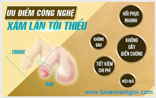 Cắt bao quy đầu bằng kỹ thuật xâm lấn tối thiểu theo công nghệ Hàn Quốc.