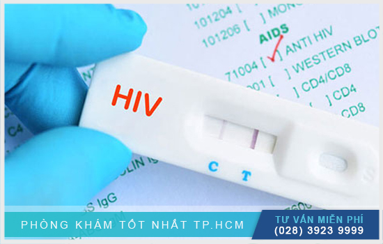 Xét nghiệm hiv ở viện Pasteur Nhung-thong-tin-can-nam-khi-xet-nghiem-hiv-o-pasteur-1