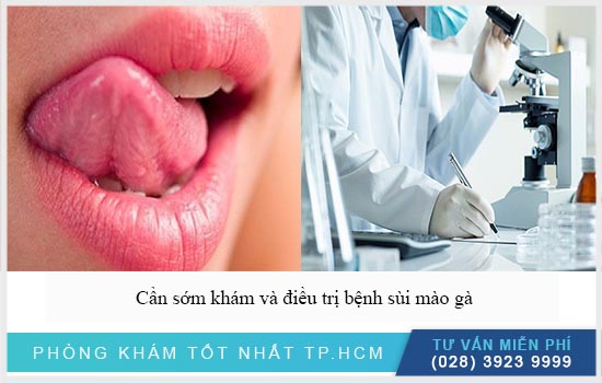 địa chỉ điều trị nổi hạt ở lưỡi