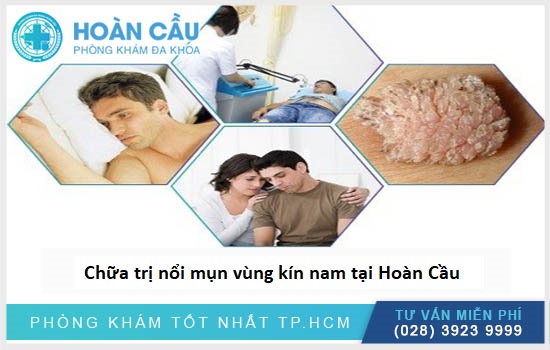 Chữa trị nổi mụn vùng kín nam tại Hoàn Cầu