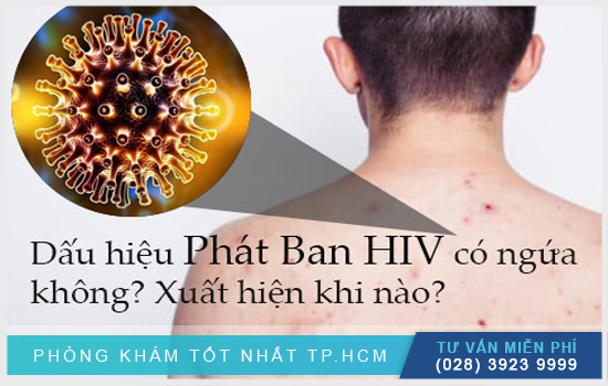 Phân tích phát ban HIV có ngứa không? [TPHCM - Bình Dương - Đồng Nai - Long An - Tiền Giang]