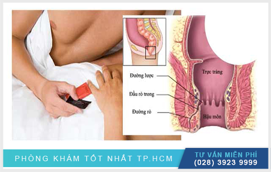 [TP.HCM] Phân tích quan hệ bằng hậu môn có ảnh hưởng gì không?