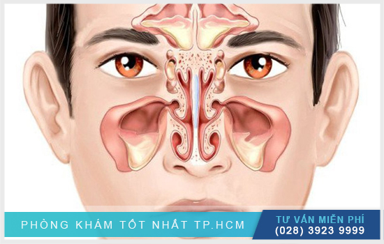 Viêm mũi có di truyền không Phan-tich-ro-hon-viem-mui-co-di-truyen-khong-2