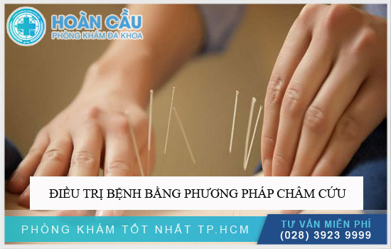 Điều trị bệnh bằng phương pháp châm cứu