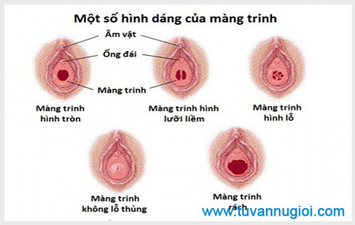 Quan hệ lần đầu không ra máu