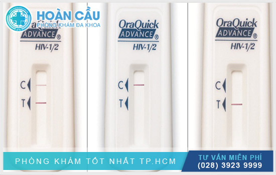 Kết quả xét nghiệm HIV với oraquick test