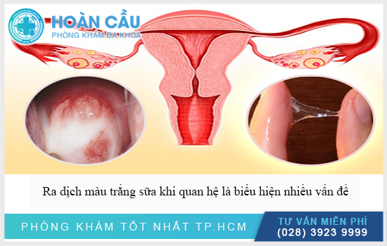 Ra dịch màu trắng sữa khi quan hệ là biểu hiện nhiều bệnh lý