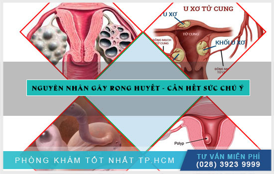 Topics tagged under titanhealthy on Diễn đàn Tuổi trẻ Việt Nam | 2TVN Forum Rong-huyet-co-nguy-hiem-khong-chi-em-nen-lam-gi1