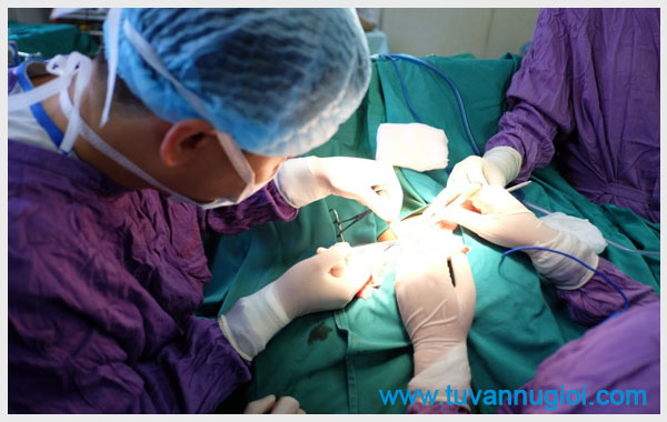 Trẻ hóa vùng kín giúp lấy lại hình ảnh cơ quan sinh dục nữ đẹp