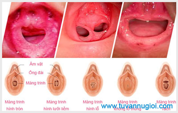 Hình ảnh bộ phận sinh dục nữ đẹp con gái