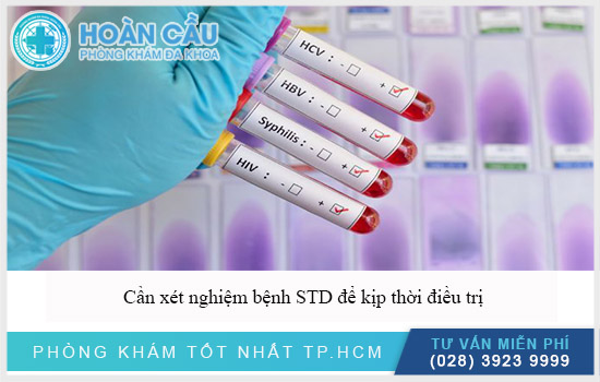 Cần xét nghiệm STD sớm để chữa trị kịp thời