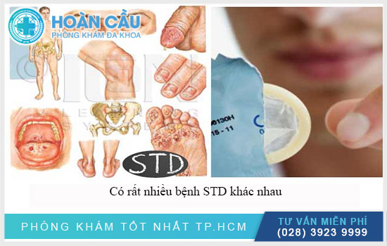 Có rất nhiều bệnh STD