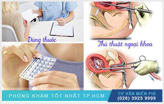 HCM - Tất tần tật phương pháp phá thai an toàn nhất  Tat-tan-tat-nhung-phuong-phap-pha-thai-an-toan-hien-nay-chi-em-can-biet-3