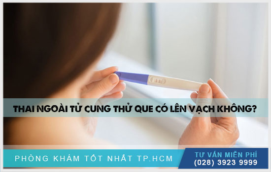 [TPHCM] Thai ngoài tử cung là gì? Thai ngoài tử cung thử que có lên vạch không?
