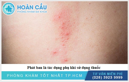 Tác dụng phụ thuốc gây phát ban