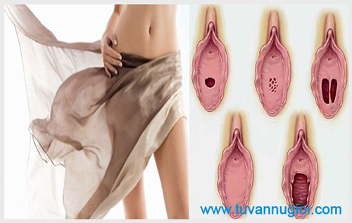 Tìm hiểu về cấu tạo màng trinh của con gái