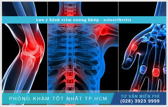 Tìm hiểu kỹ hơn về bệnh viêm xương khớp - osteorthritis [TPHCM - Bình Dương - Đồng Nai - Long An - Tiền Giang]