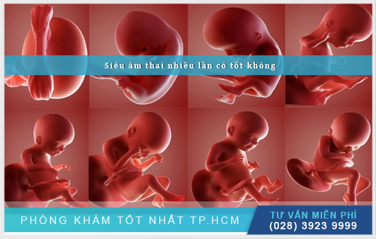 Siêu âm thai nhiều có ảnh hưởng gì không