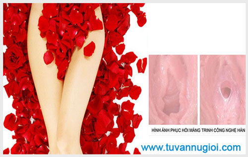 Tìm hiểu về các phương pháp vá màng trinh