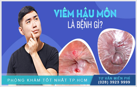 [TP.HCM] Tìm hiểu viêm hậu môn và nguyên nhân, cách điều trị hiệu quả