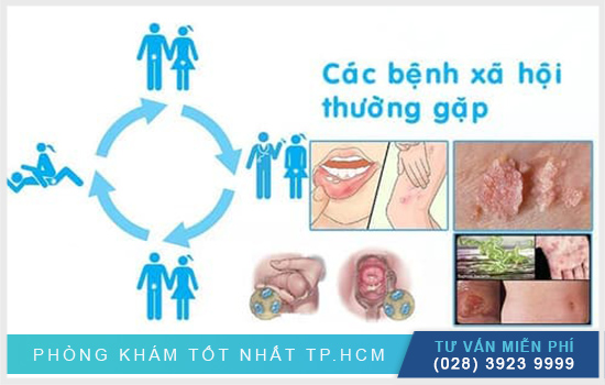Tổng đài tư vấn bệnh xã hội trực truyến HCM Tong-dai-tu-van-benh-xa-hoi-uy-tin-an-toan-nhat-hien-nay-2