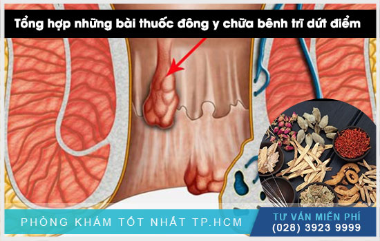 Tổng hợp những bài thuốc đông y chữa bệnh trĩ tốt hiện nay