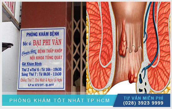 Phòng khám bệnh Trĩ Tphcm Quận 5 chất lượng Top-5-dia-chi-phong-kham-tri-quan-5-uy-tin-2021-2