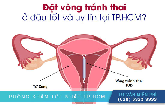 Tư vấn các phương pháp và địa chỉ tránh thai an toàn tại TPHCM [Bình Dương - Đồng Nai - Long An - Tiền Giang]