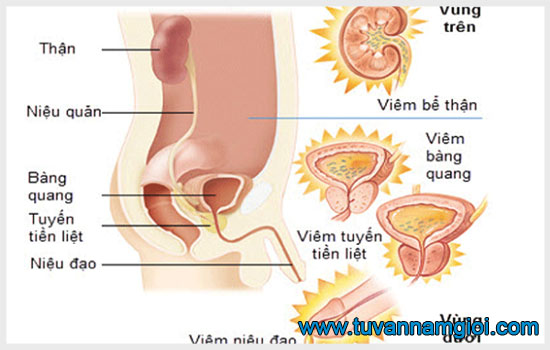 Viêm đường tiết niệu: Biểu hiện và cách điều trị