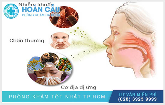 Viêm mũi dị ứng: Nguyên nhân, triệu chứng và cách chữa