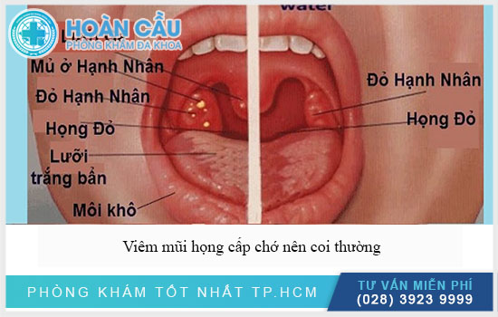 Viêm mũi họng cấp là gì? Nguyên nhân và giải pháp chữa trị