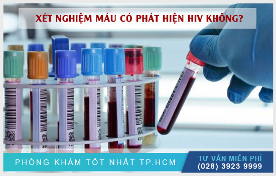 [TP.HCM] Xét nghiệm máu thông thường có phát hiện HIV hay không?