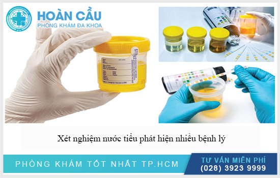 Xét nghiệm nước tiểu để làm gì? Quy trình thực hiện ra sao?