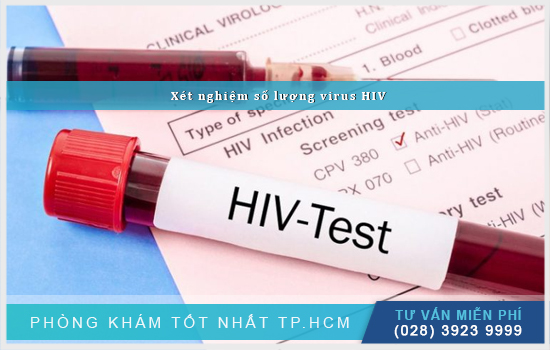 Xét nghiệm số lượng virus HIV là gì, thực hiện ra sao?
