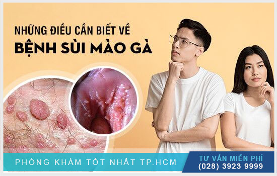 xét nghiệm sùi mào gà là xét nghiệm gì