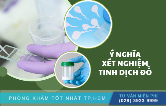 Tầm quan trọng xét nghiệm tinh dịch đồ nam giới nên lưu ý